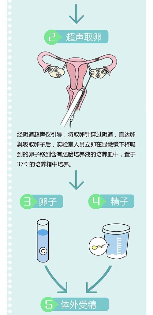 北京供卵试管流程(北京供卵试管流程解析)
